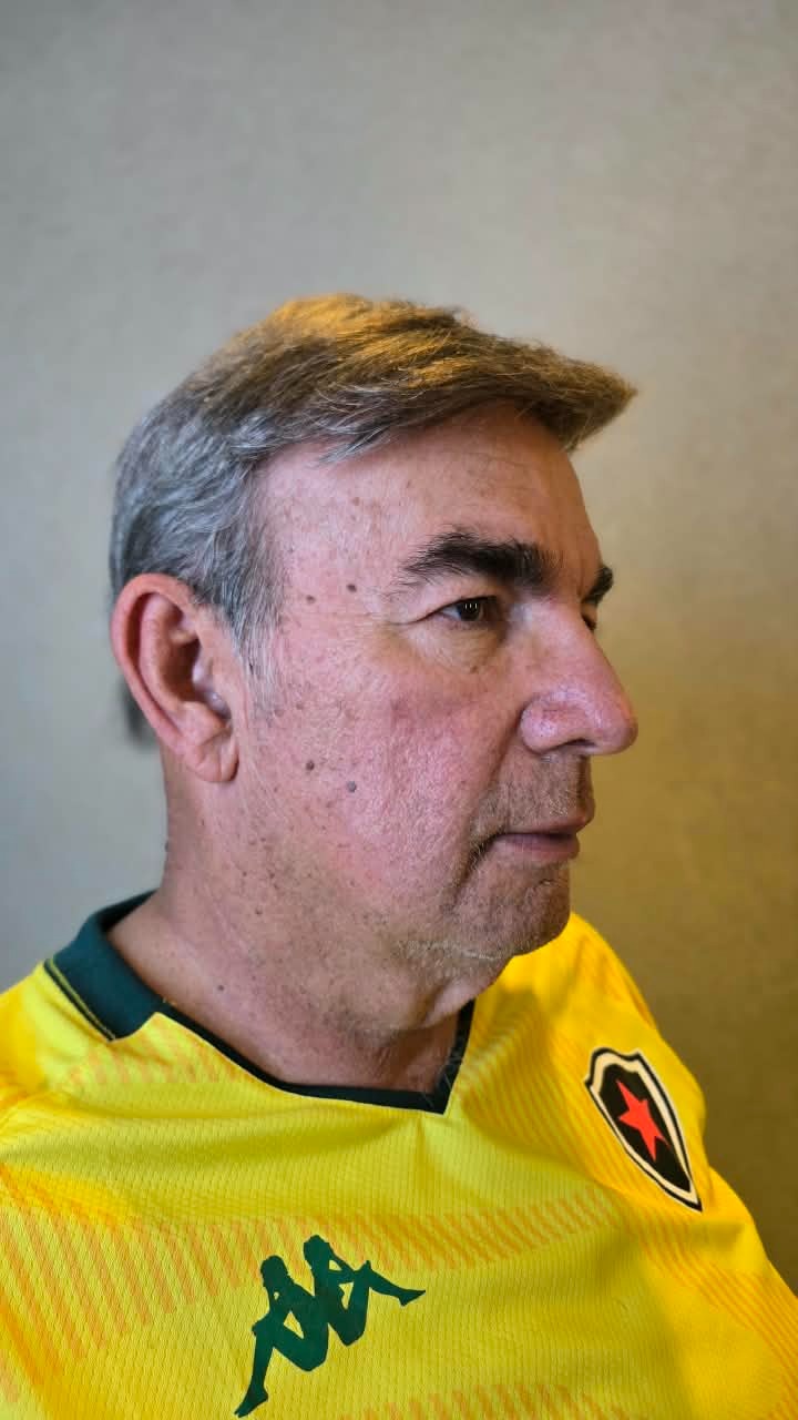 Depois: cliente com prótese capilar aplicada, cabelo grisalho natural e volumoso